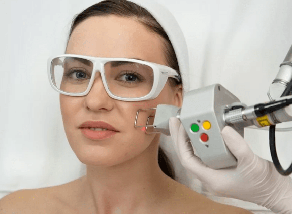 Laser rejuvenation field