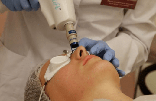 Undeniable laser rejuvenation